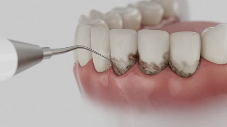 Trusted Teeth Cleaning And Checkup service in Portland, OR - Dentist Open Now